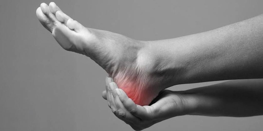 Fascitis plantar - Dolor de talón